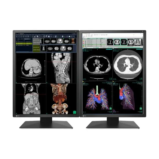Medical Monitor EIZO Radi Force RX270 - 21.3 Medical Monitor EIZO Radi Force RX270 - 21.3