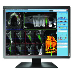 Medical Monitor EIZO RadiForce MX216-SB 2MP Цветен