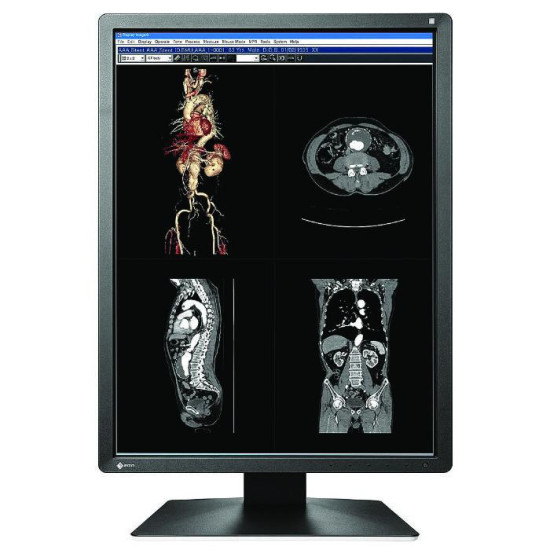 Medical Monitor EIZO RadiForce MX216-HB 2MP, Color Medical Monitor EIZO RadiForce MX216-HB 2MP, Color