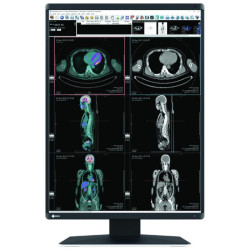 Medical Monitor EIZO RadiForce RX370 3MP, Color
