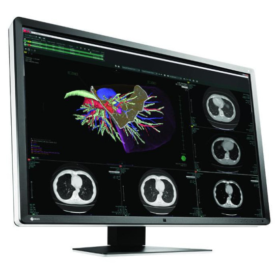 Медицински монитор EIZO RadiForce RX660 6MP Цветен Медицински монитор EIZO RadiForce RX660 6MP Цветен