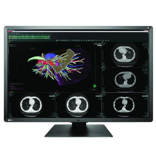 Медицински монитор EIZO RadiForce RX660 6MP Цветен Медицински монитор EIZO RadiForce RX660 6MP Цветен