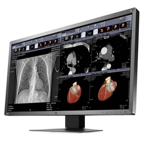 Медицински монитор EIZO RadiForce MX315W 8MP Цветен Медицински монитор EIZO RadiForce MX315W 8MP Цветен
