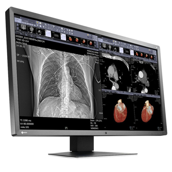 Медицински монитор EIZO RadiForce MX315W 8MP Цветен Медицински монитор EIZO RadiForce MX315W 8MP Цветен